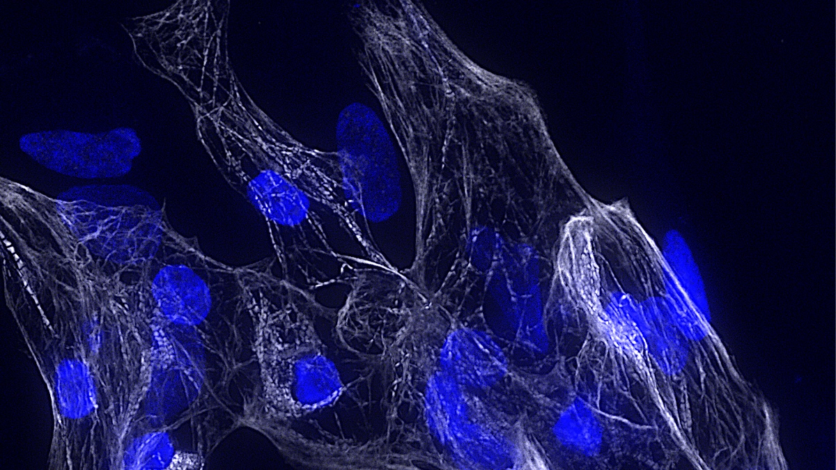 Scoperto un nuovo gene chiave per la salute del cuore