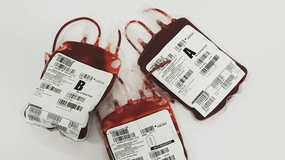 Anemia sideropenica: in Israele ne soffre un giovane su quattro