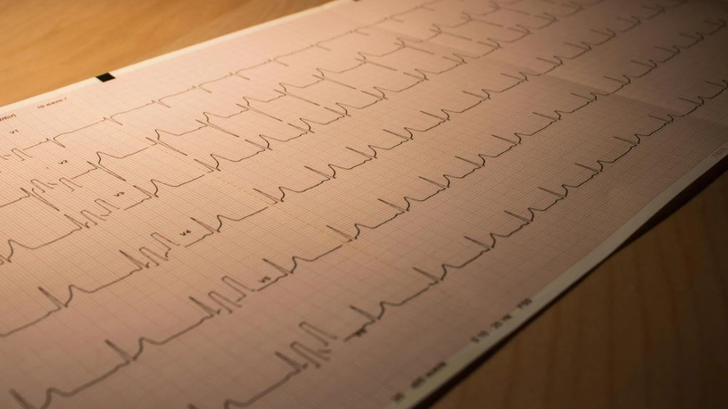 L'assunzione continuata di melatonina potrebbe essere collegata all'insufficienza cardiaca