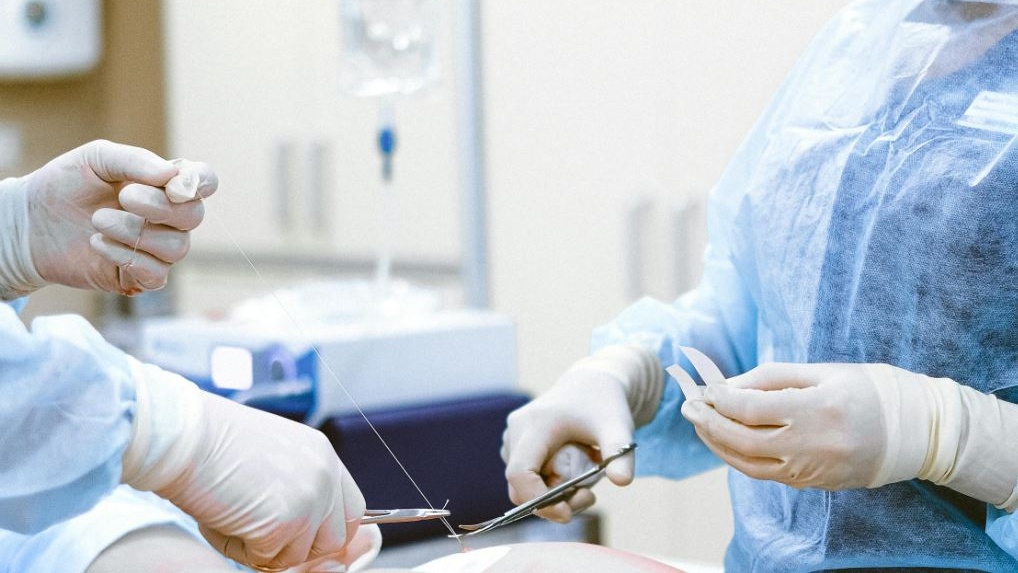 Tumore del polmone iniziale: lo studio decennale ribalta la segmentectomia