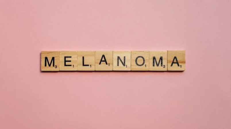 Cancro: scoperto come il melanoma inganna il sistema immunitario