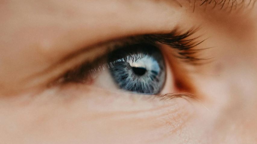 La sindrome di Waardenburg, la malattia degli occhi azzurri che può portare alla sordità