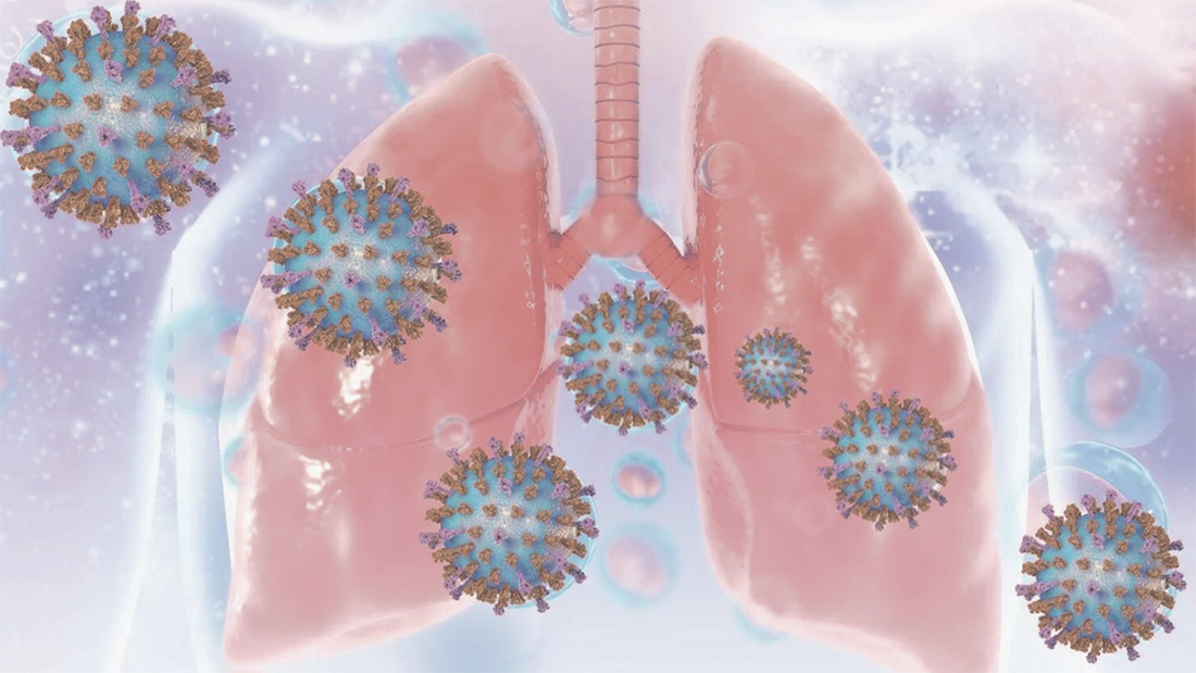 Virus respiratorio sinciziale: copertura neonatale oltre l’80%, ma l’Italia resta spaccata