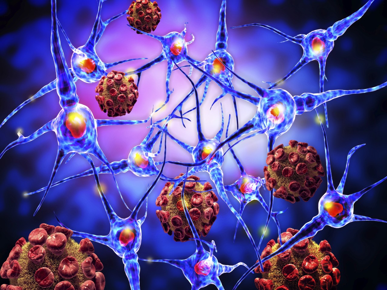L’ITALIA, MODELLO PER LA SCLEROSI MULTIPLA