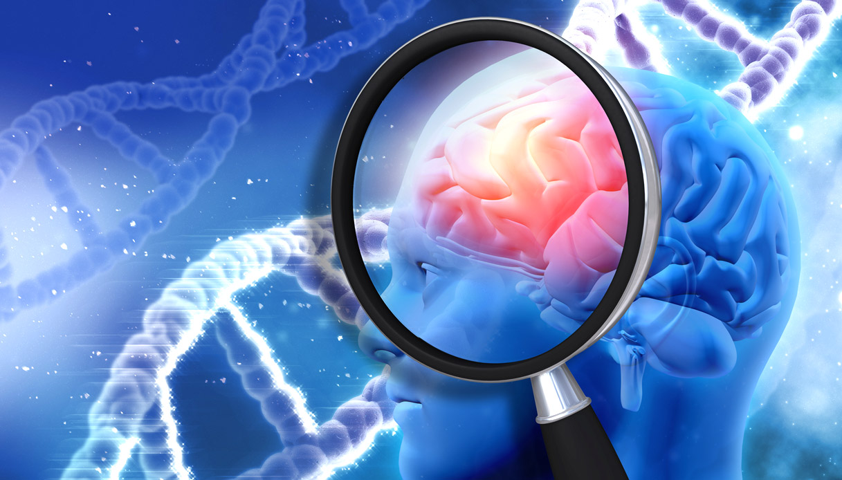Alzheimer: l' approccio per individuare le predisposizioni genetiche è machine learning