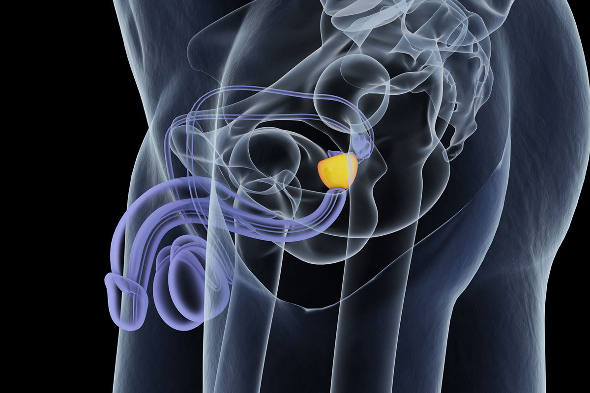 VIA LIBERA ALLA TERAPIA INNOVATIVA CONTRO IL CANCRO ALLA PROSTATA