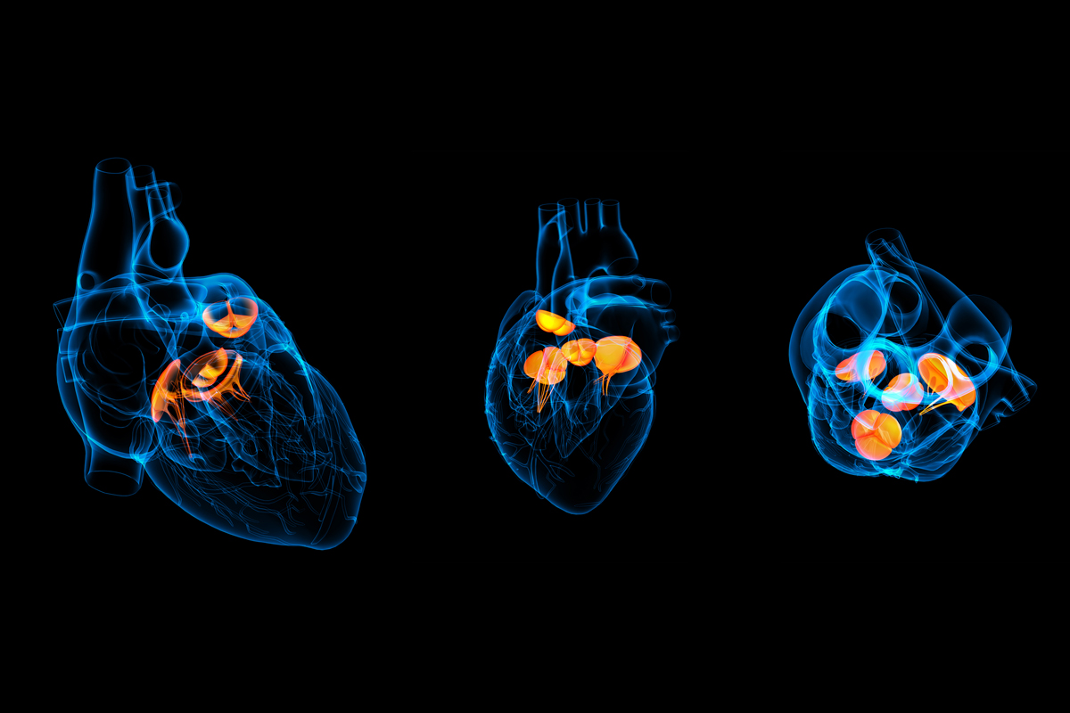 SETTIMANA EUROPEA SULLE MALATTIE DELLE VALVOLE CARDIACHE: IN CRESCITA PROCEDURE INNOVATIVE DI INTERVENTO