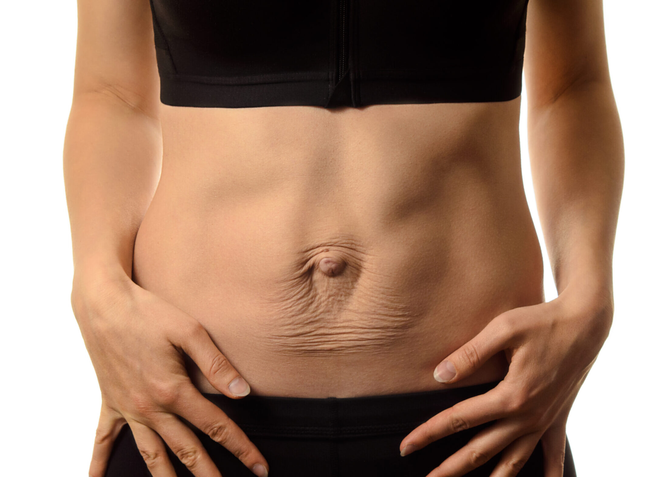 THE CORRELATION BETWEEN DIASTASIS RECTI AND BREATHING DISORDERS