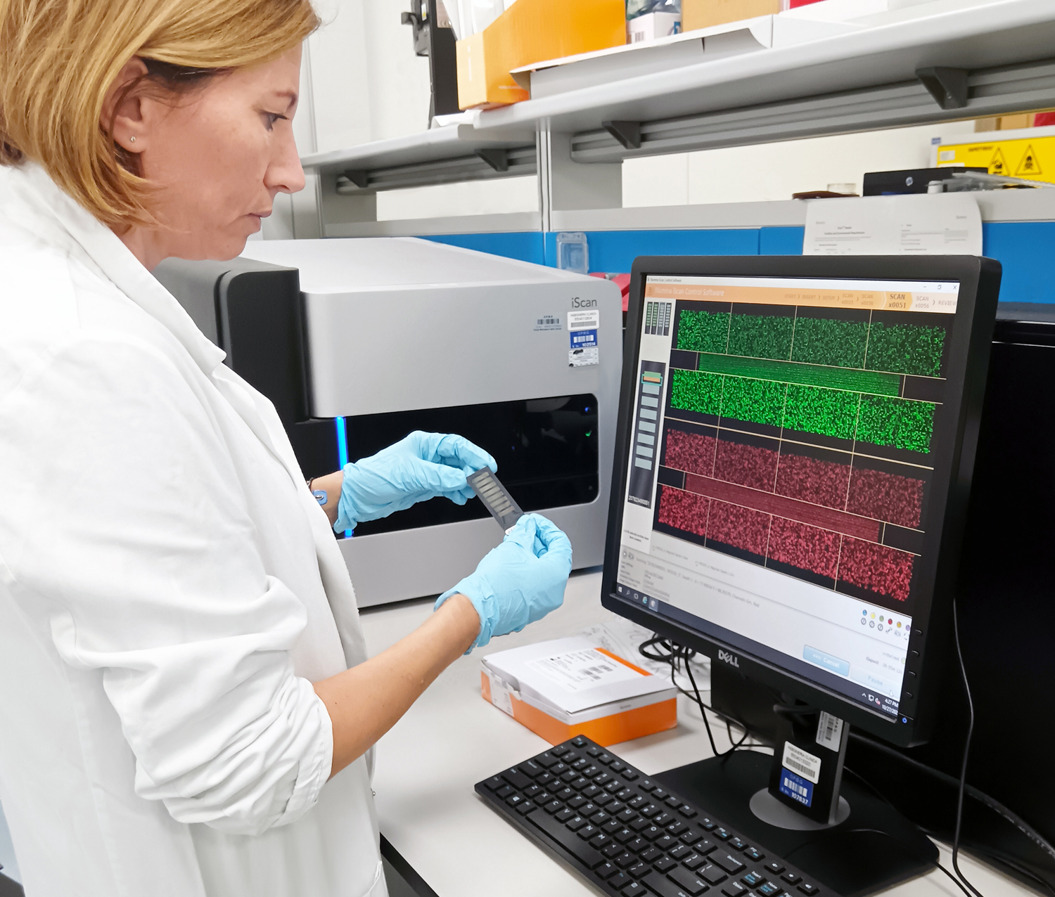 SCOPERTA LA “FIRMA MOLECOLARE” PER LA DIAGNOSI DELL’ANEMIA DI FANCONI