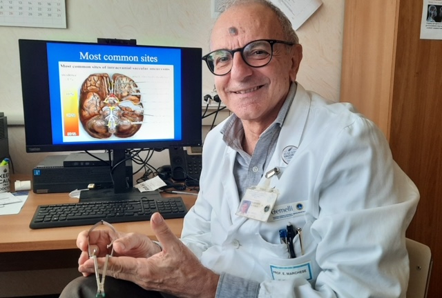 ANEURISMI CEREBRALI: IL TRAINING DEI NEUROCHIRURGHI DEL FUTURO