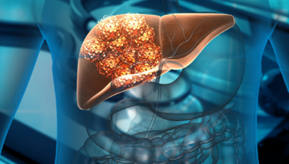 Cachessia: la comunicazione tra cervello e fegato fattore critico dello sviluppo della malattia