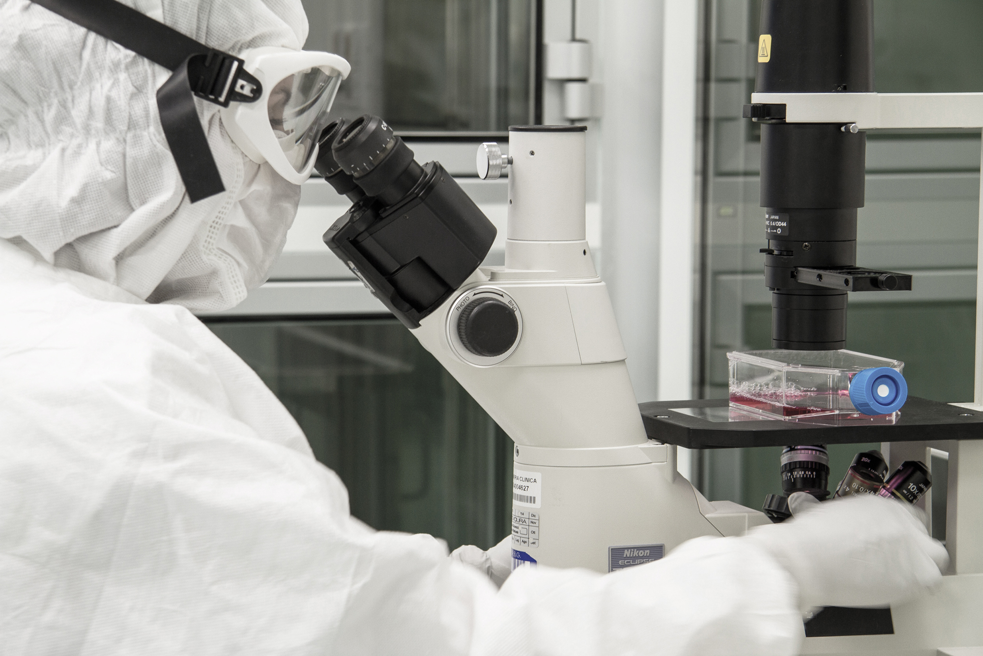 TRATTATA CON CAR-T LA PRIMA PAZIENTE CON SCLEROSI SISTEMICA