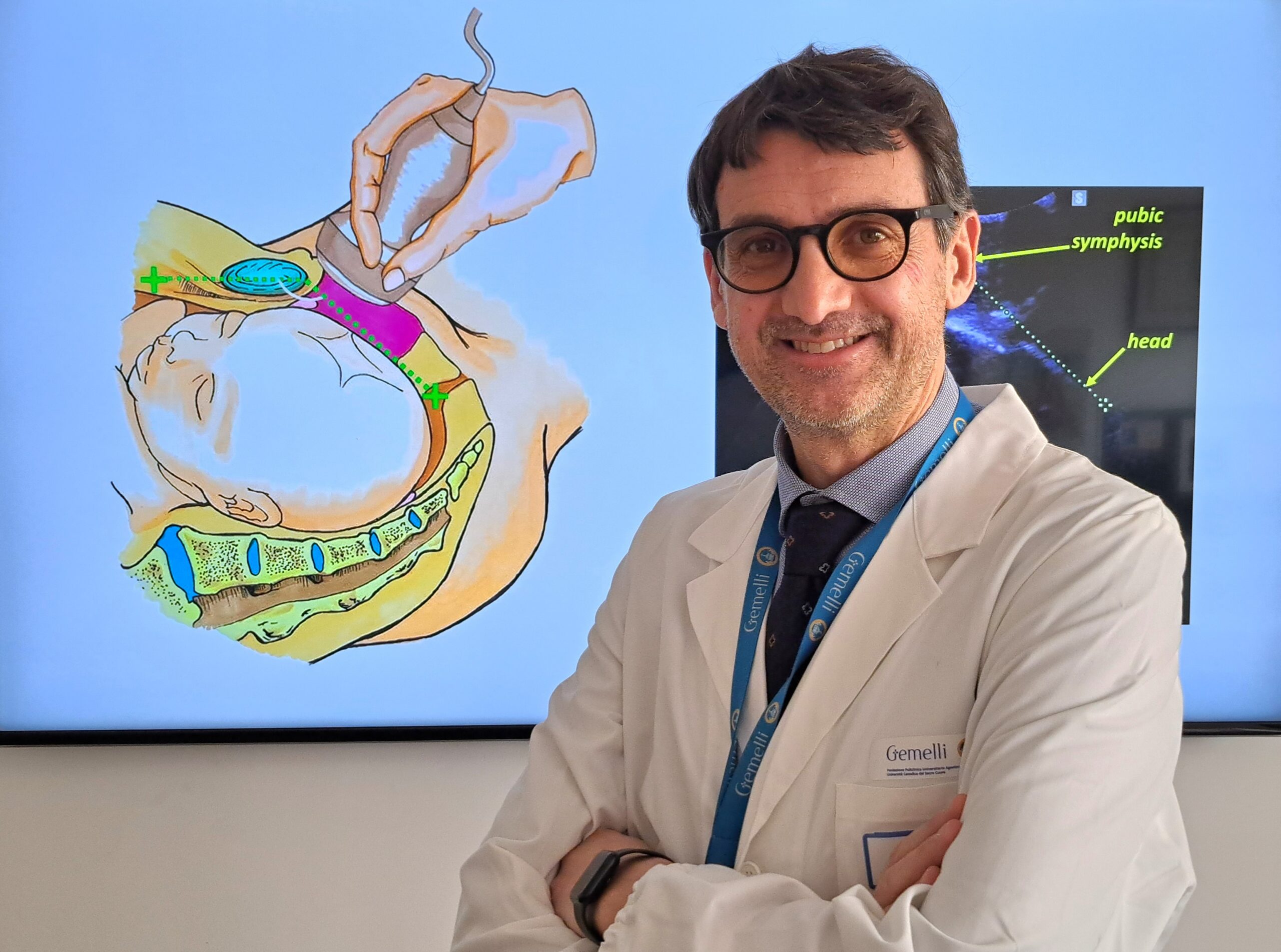 Un’innovativa ecografia trans-perineale per ridurre i tagli cesarei