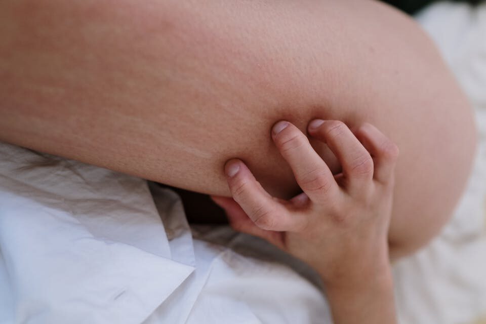 Dermatite atopica, visite gratuite al Policlinico di Catania