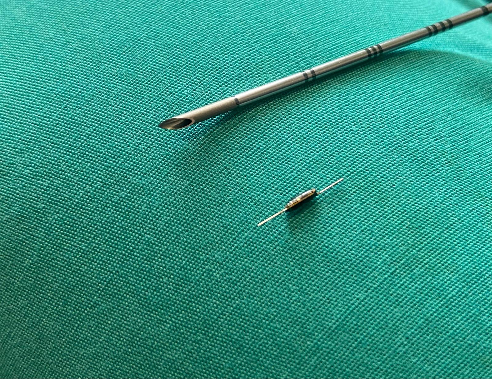 Tumori al seno, al San Camillo il dispositivo per la localizzazione delle neoplasie