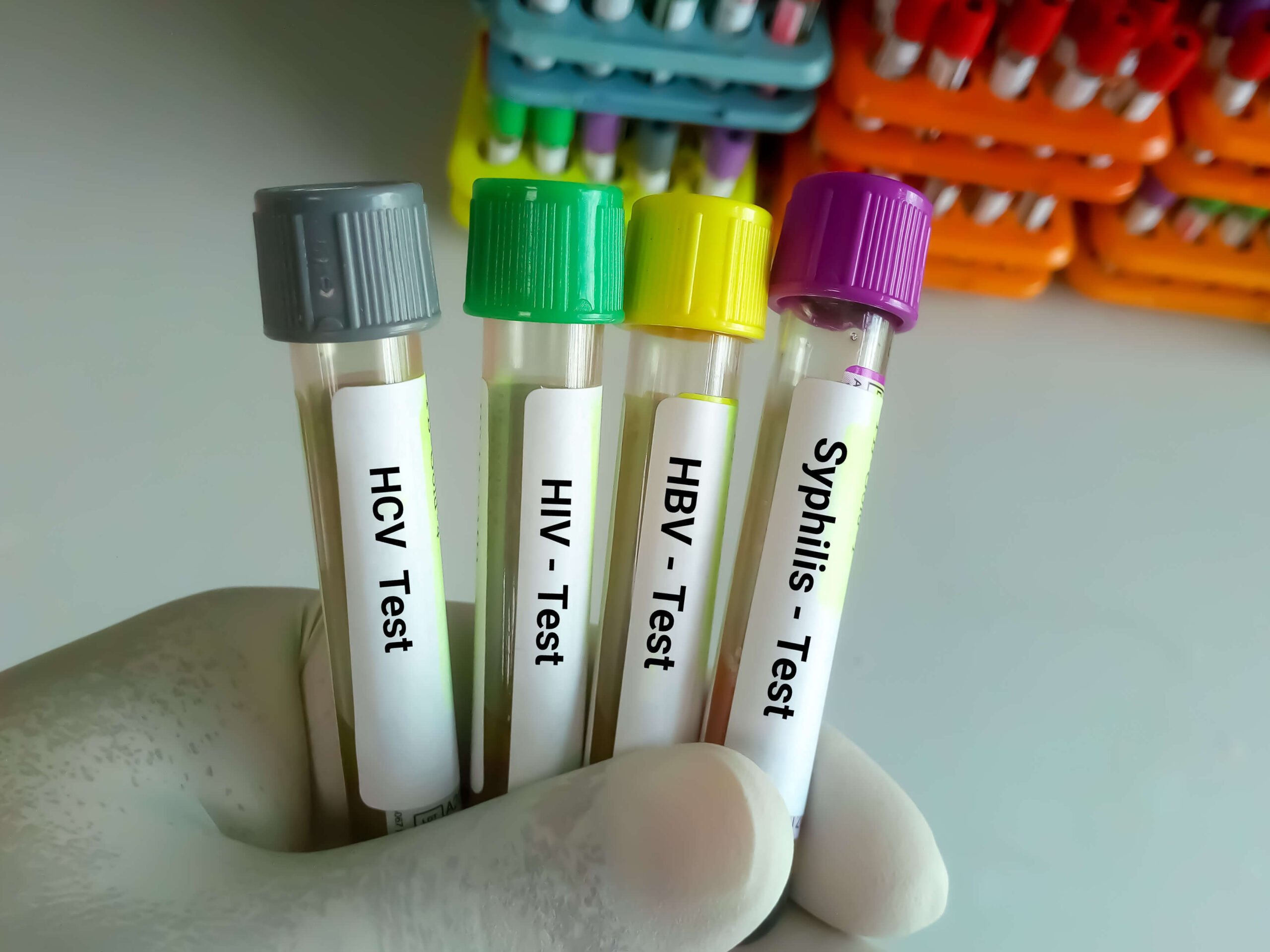 L'Europa non è sulla buona strada per raggiungere gli obiettivi relativi alle malattie infettive