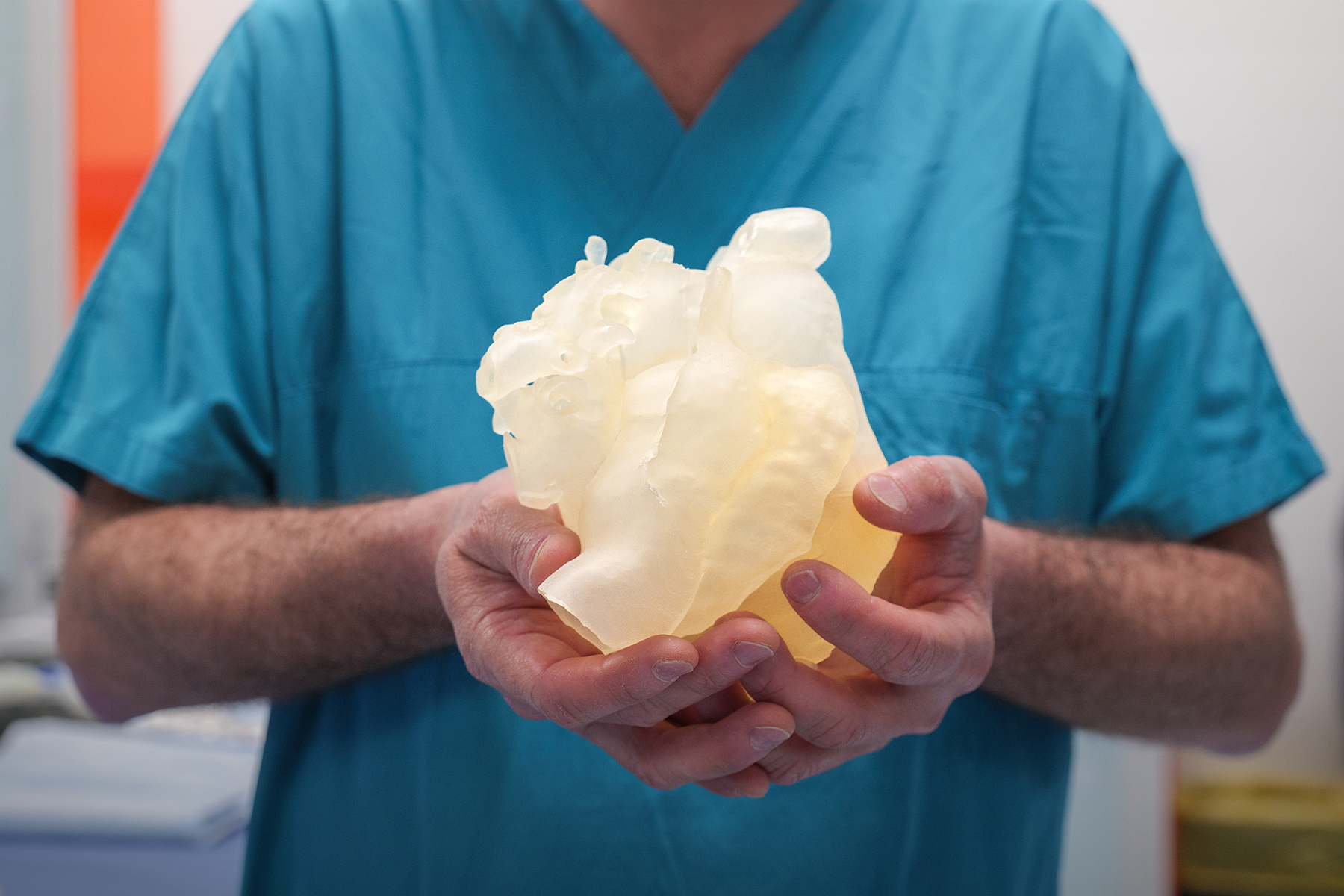 Salvato un 32enne grazie a un intervento innovativo di cardiologia mininvasiva