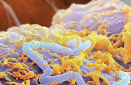 In aumento le infezioni da E.Coli e Listeria in Europa: nel 2023 i livelli più alti mai registrati