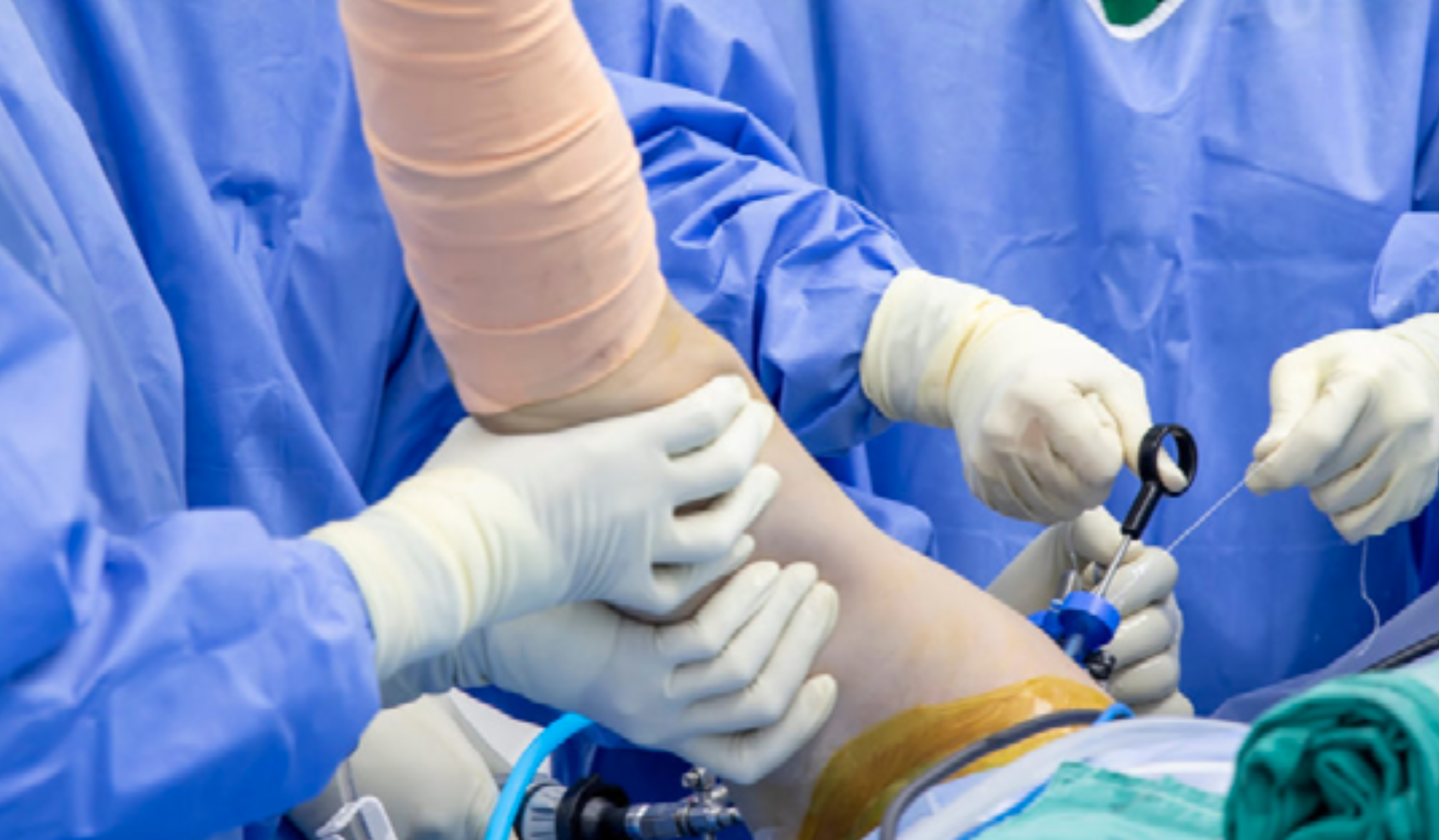 Chirurgia della spalla: artroscopia, traumi e protesi