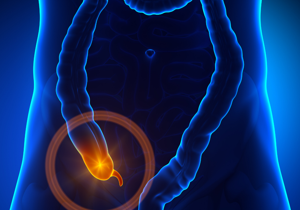 Tumori all’appendice in aumento tra i giovani: allarme negli USA