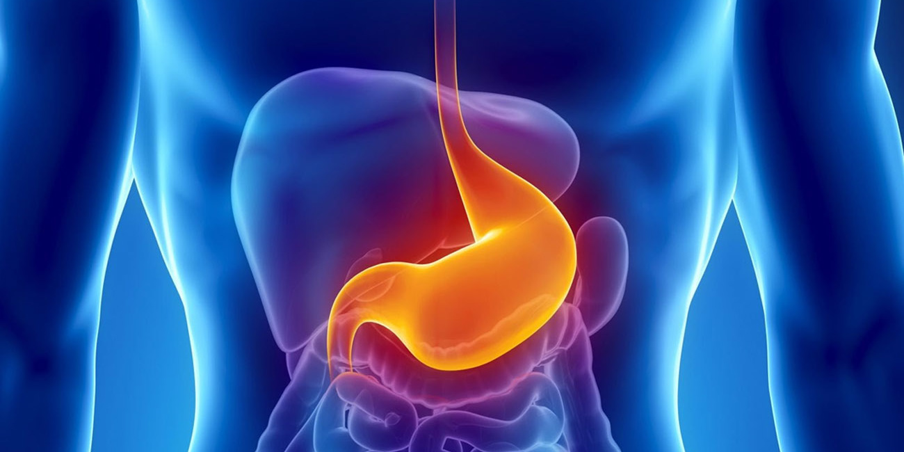 Reflusso gastroesofageo: d’estate i sintomi peggiorano. Ecco come difendersi