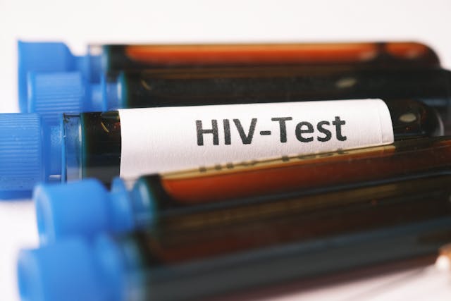 Sull’HIV occorre accelerare su prevenzione e cura multidisciplinare